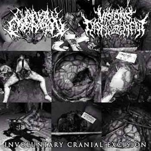 Involuntary Cranial Excision (Split)