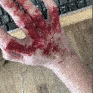 Avatar for blood splattered everywhere