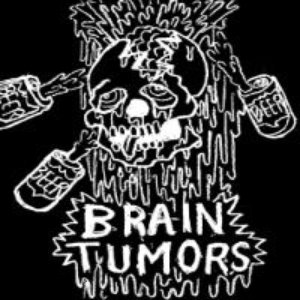 Brain Tumors