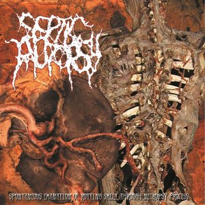 Spontaneous Emanation Of Rotting Smell Through Necropsy Process