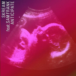 Skream - Anticipate Lyrics - Zortam Music