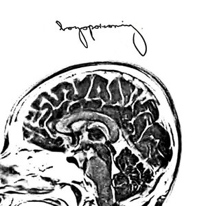 Boyopoisoning