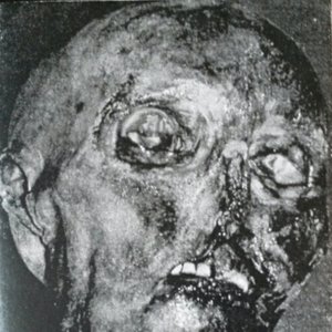 Bullets For German Radio