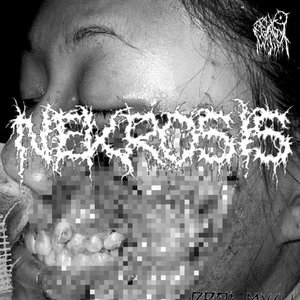 NEKROSIS