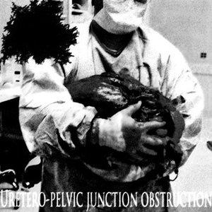 Uretero​-​Pelvic Junction Obstruction