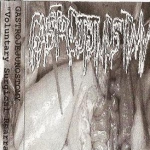 Gastrojejunostomy 的头像