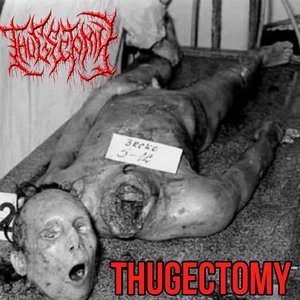 Thugectomy