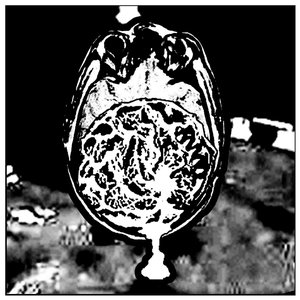 Cerebrum Daemonia