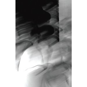 Dual (Hollow)