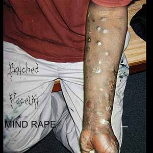 “Mind Rape”的封面