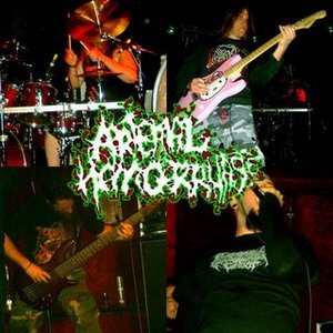 Аватар для Arterial Hemorrhage