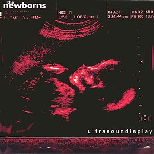 Ultrasoundisplay