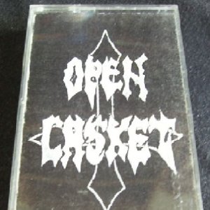 Open Casket