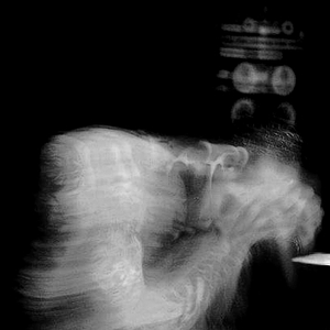 Control photo provided by Last.fm