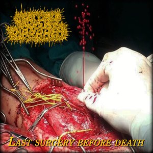 Last Surgery Before Death