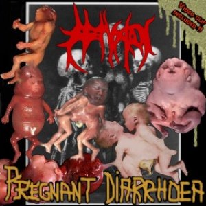 Pregnant Diarrhoea