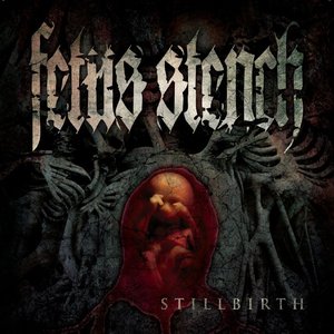 Stillbirth