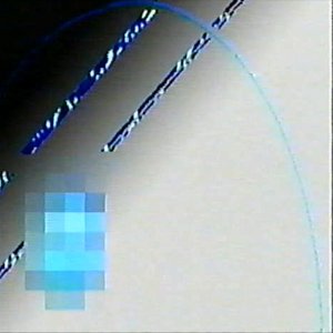 exsect