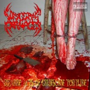 Bizarre Acts Of Gruesome Torture