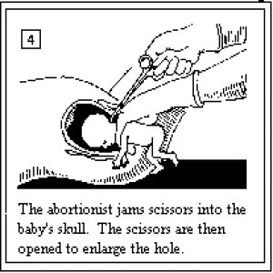 abortionist ep