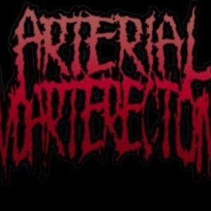 Arterial Endarterectomy 的头像