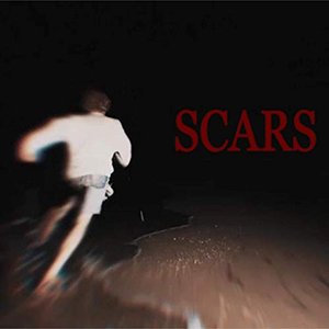 Scars