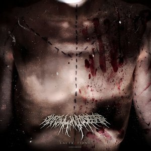 Lacerations: Autopsy Edition