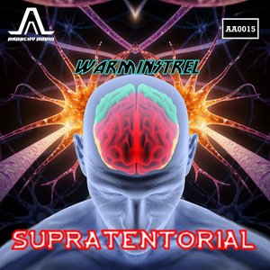 Supratentorial