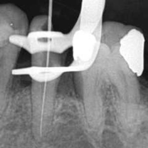 Avatar for Dental Drill Slips