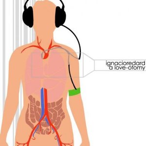 A Love-Otomy
