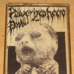 Gestation Human Dismembered