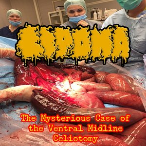 The Mysterious Case of The Ventral Midline Celiotomy