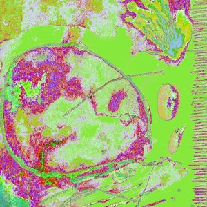 first gig (Remix)