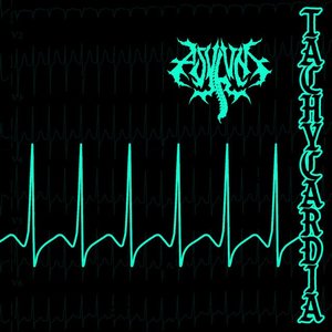 Tachycardia
