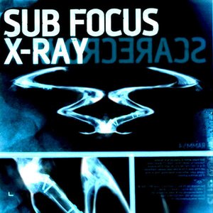 X Ray - Single