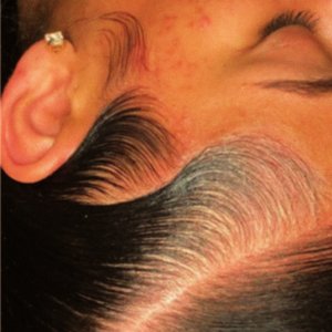 Babyhair