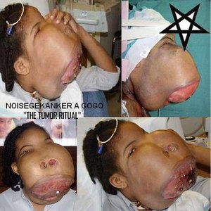 The Tumor Ritual
