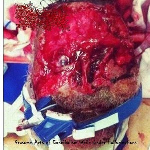 Gruesome Acts of Cannibalism While Under Hallucinations