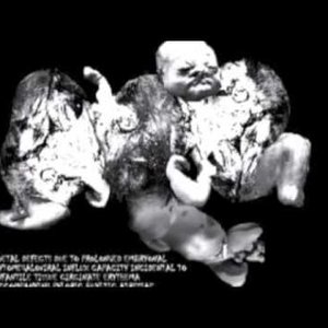 Foetal Defects Due To Prolonged Embryonal Cytomegaloviral Influx Capacity Incidental To Infantile Tissue Circinate Erythema Accompanying Pyloric Buyltic Atresiae のアバター