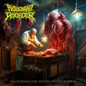 Malformacion Severa Intracraneal