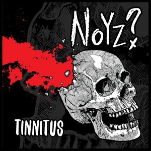 Tinnitus