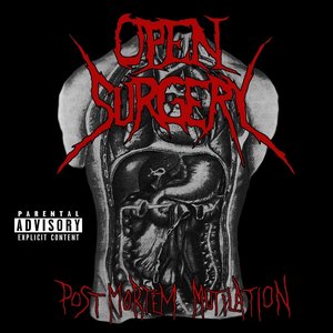 Post Mortem Mutilation