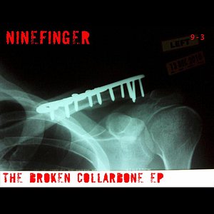 The Broken Collarbone EP