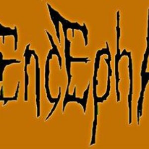 Image for 'Exencephaly'