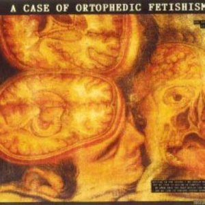 A Case Of Ortophedic Fetishism