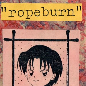 Ropeburn