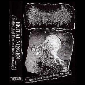 Melted And Faceless Body Autopsy
