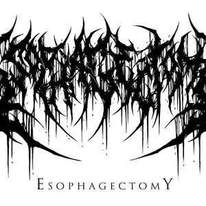 Avatar for Esophagectomy