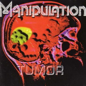 Tumor