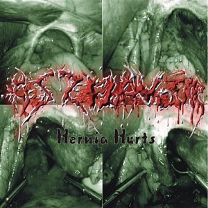 Hernia Hurts